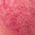 Redness & Sensitivity
