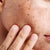 Dark Spots