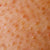 Rough, bumpy skin