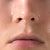 Oily Skin