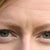 Premature Aging Skin