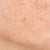Uneven Tone
